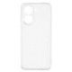 UNITHIN For Xiaomi Redmi A5 NFC (EU) (173.45mm) Case Ultra Thin 0.7mm Clear TPU Anti Drop Phone Cover Precise Cutouts XIAOMI Cases Mobile